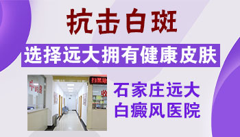 儿童脸上白斑,是过敏在作怪吗?