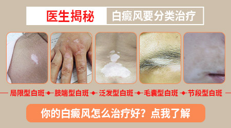 新生儿白癜风图片解析及小孩长斑原因探讨