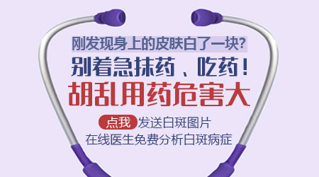 石家庄儿童白癜风医院治白斑贵不贵?