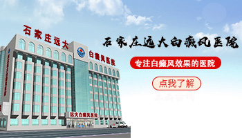 探究女性嘴角白癜风起因，了解背后的真相