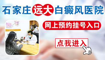 308准分子激光治疗白癜风费用详解