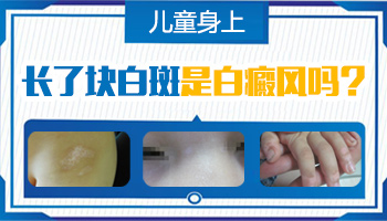 男性私处白癜风两年了扩散了能治好吗?”