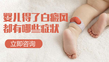 治疗儿童白癜风哪种药效果好?