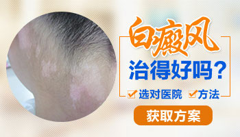 孩子感冒持久未愈,竟引发白癜风?应对策略来了!