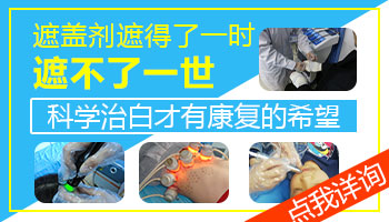 儿童白癜风做308激光治疗多长时间能好转?