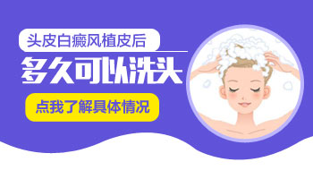 白癜风怎么治疗好?专业解答与科学方案