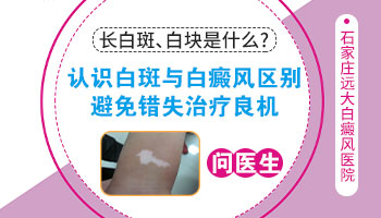 女性面部白癜风,如何应对更有效?