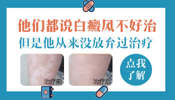 婴儿大腿内侧皮肤不规则发白?这里有你想要的答案!