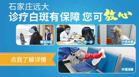 头部纯白色白癜风适合做308激光吗
