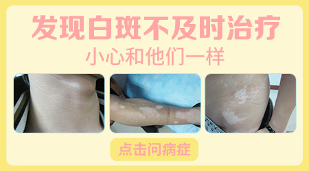 孩子身上出现的小白点,究竟是什么呢?