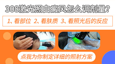 儿童白癜风光疗多久能治好?详解与指导