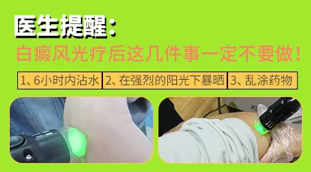 探索更优方案:如何有效治疗儿童白癜风?”