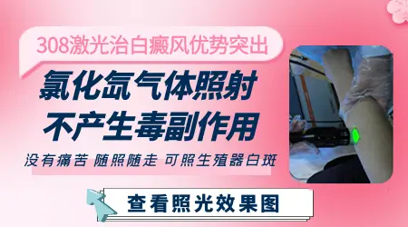 儿童治疗白癜风，什么时机更好？