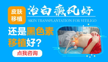 成年女性白癜风大面积扩散，有效预防策略大揭秘！