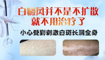 白癜风遗传几率怎么算？”