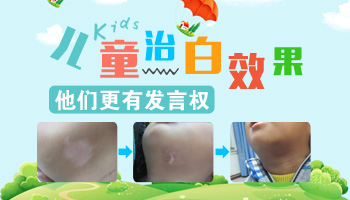 `患有白癜风，我还能迎来新生命吗？`