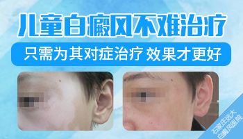 孕妇白癜风发展期,如何有效管理与控制?