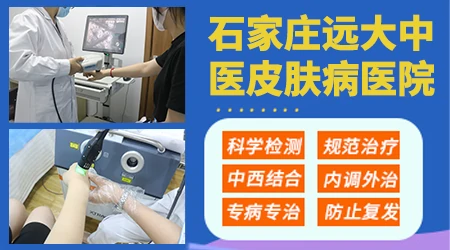 一岁宝宝脸蛋上长光滑的白点是白癜风吗?”