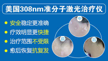 孩子手上突然出现一块白色斑块是什么？”