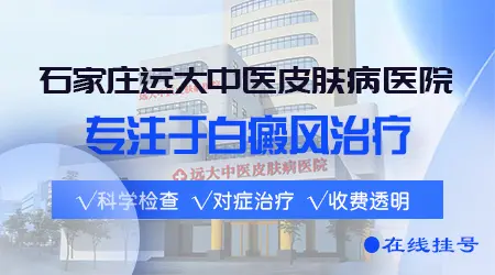 `孕妇患有白癜风应该注意什么`