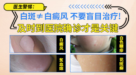 如何正确治疗儿童白癜风,家长必看指南”