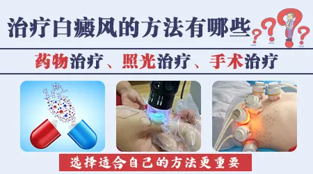孩子8岁生殖器上长白癜风怎么办