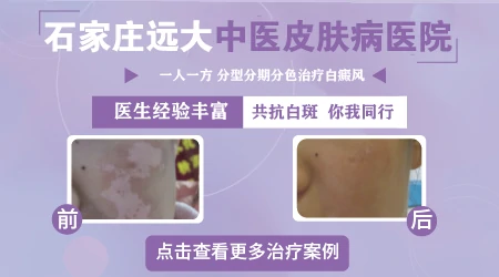 308光照白斑后起泡影响效果吗?全面解析与应对策略”