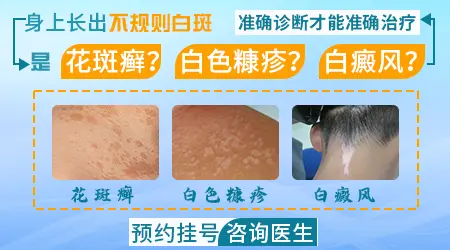 孕妇患上白癜风可以照308光疗灯吗？”