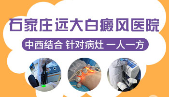 女性白癜风会不会遗传给孩子?