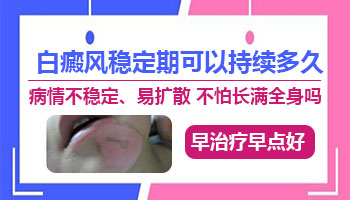 小孩子用补骨脂注射液治白癜风会影响身体吗?”