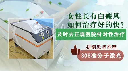 白癜风以前治疗过现在复发了怎么办