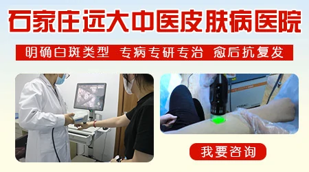 孕期吃维生素C会让宝宝得白癜风吗?