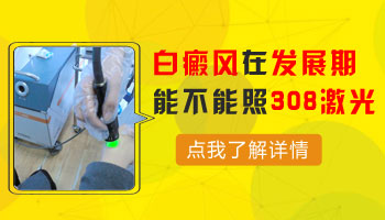 `宝宝额头出现白斑,家长别急,先来了解这些可能的原因`