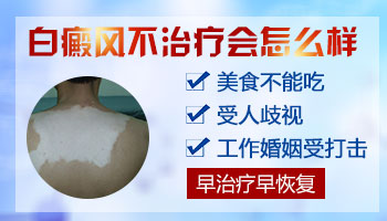 是不是白癜风都要黑色素移植？