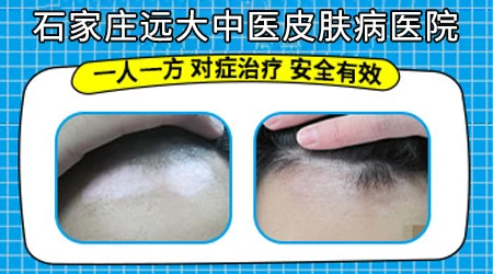 男性生殖器上长白块是什么原因