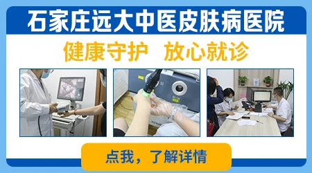 皮肤白班知多少：原因、症状与应对策略”