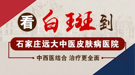 治疗小儿白癜风时,家长需留心的几个关键点