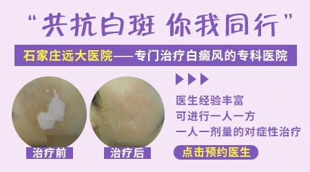 冻疮竟与白癜风有关联?揭秘两者之间的微妙联系”