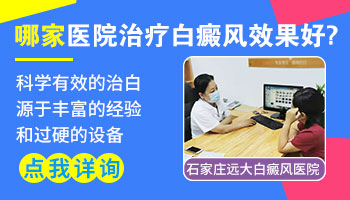 孕妇身上有白癜风用什么药物更安全”