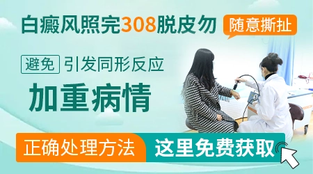 女性治疗白癜风可以用偏方吗？”