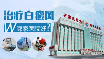 女性头部白癜风该如何治疗”