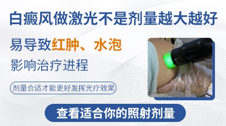 女性白癜风如何治疗效果更好