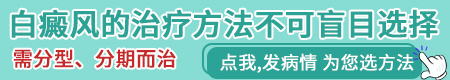 幼儿白癜风有哪些表现症状呢”
