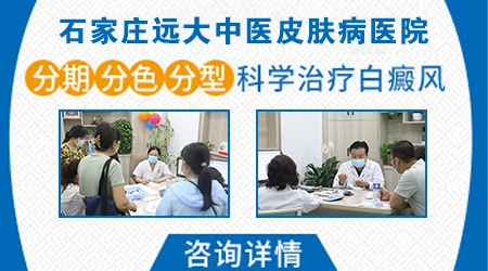 婴儿得白癜风有什么症状?能治疗好吗?