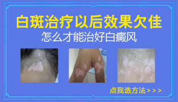 家长们,你们了解孩子患上白癜风的原因吗?”