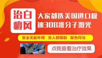 孩子脸上、手上、腿上都有白癜风怎么治