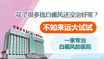 女性白癜风，真的能治好吗？