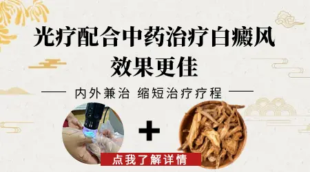 婴儿用伍德灯检查白癜风对身体有影响吗”