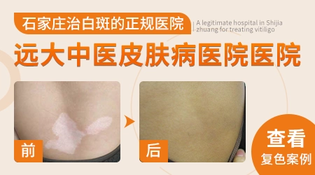 一周岁宝宝脸上为何出现豆子大白点？家长必看！