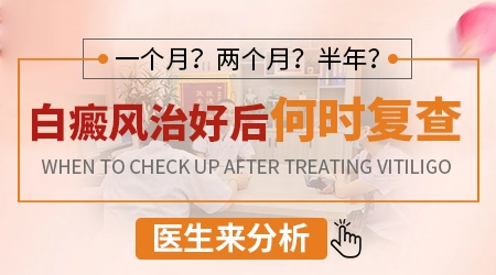 孩子脸上有白癜风应该怎么治疗”